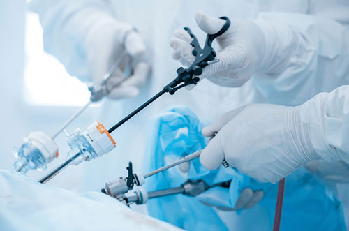 Laparoscopic Surgery